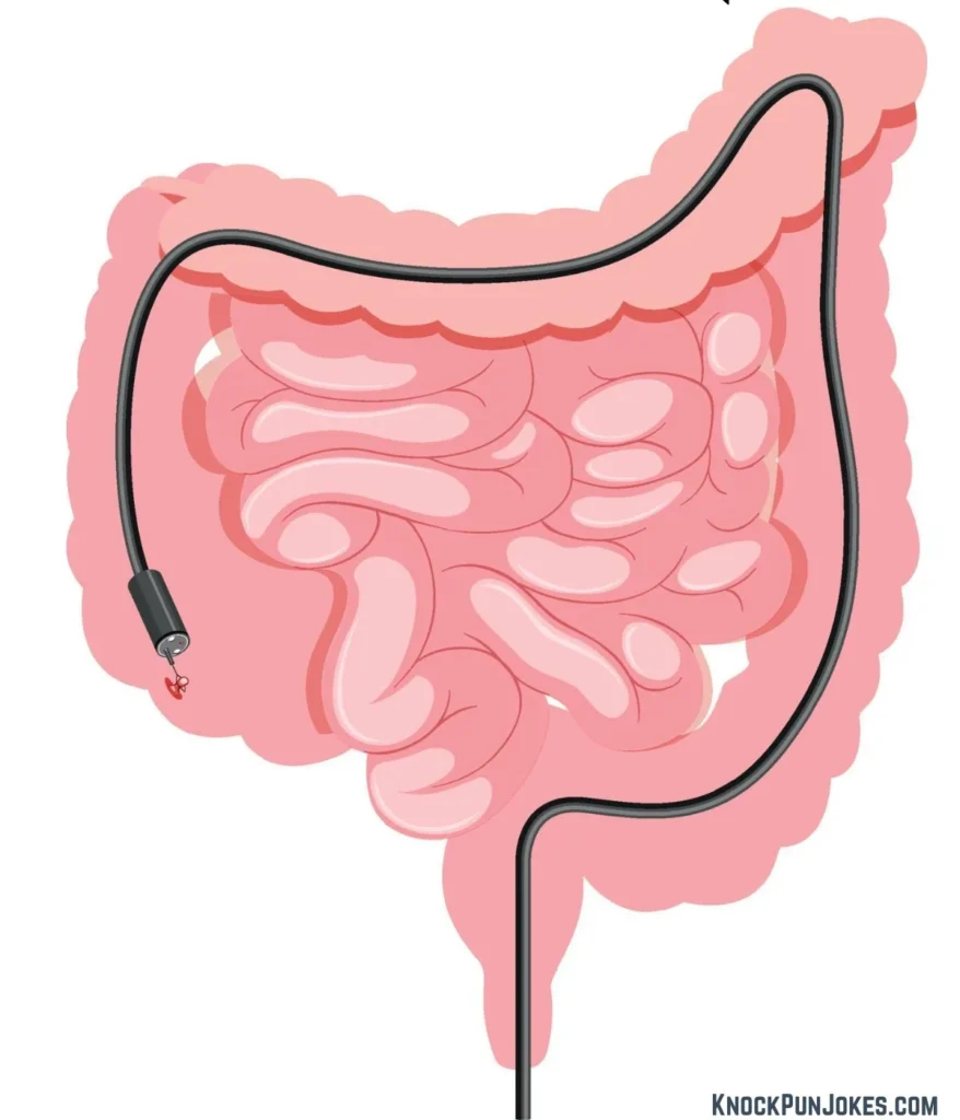 colonoscopy-jokes-puns-to-text-your-friends